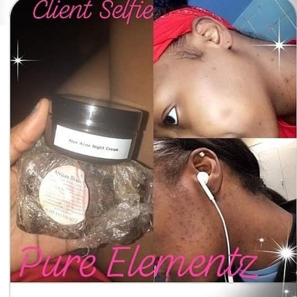 African Black Soap - Picture 2 of 5